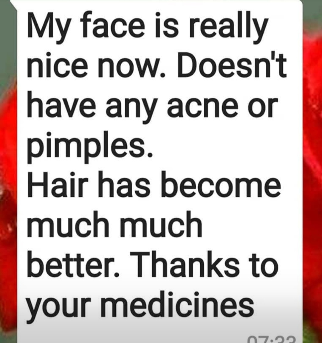 Acne pimples and hair improved